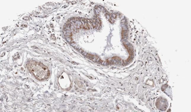 Wnt11 Rabbit Polyclonal Antibody