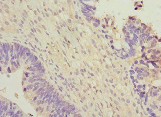 WNT7B Antibody