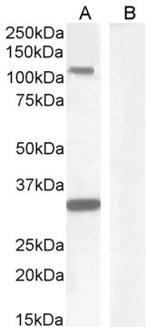 KIT/CD117 Antibody