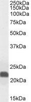 Caveolin 1 Antibody
