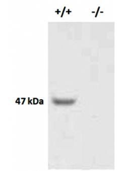 X-linked interleukin-1 receptor Antibody