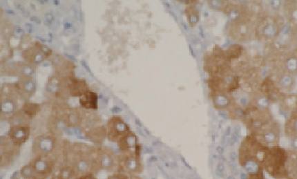 Mouse anti Human Cytochrome P450 2A6 Antibody