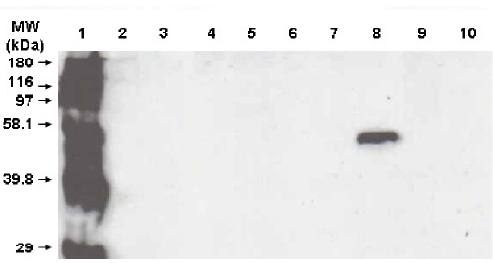 Mouse Human Cytochrome P450 3A5 Antibody