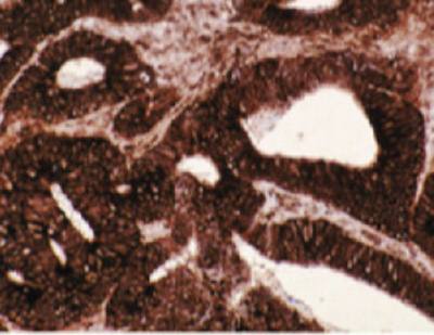 Mouse Human T-Complex Protein 1, subunit Antibody