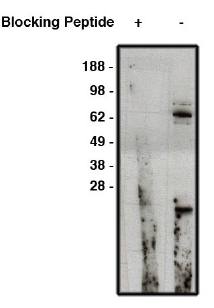 Rabbit anti Human NUMB Antibody