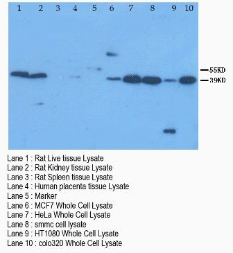 XIAP-associated factor 1 XAF1/XIAP Rabbit Polyclonal Antibody