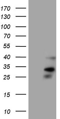 NHEJ1 Antibody