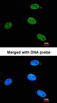 XPB Rabbit Polyclonal Antibody