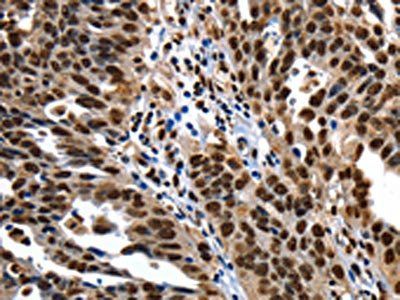 XRCC6 Antibody