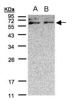 PFKFB3 Rabbit Polyclonal Antibody