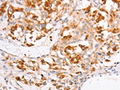 YARS2 Antibody