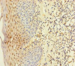 YME1L1 Antibody