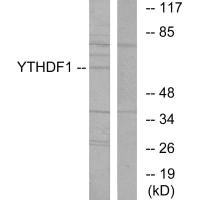 YTHDF1 Antibody