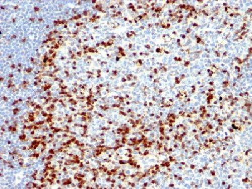ZAP70 Antibody