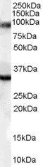 ZASP/ CYPHER/LDB3 Antibody