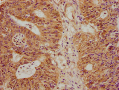 ZBED3 Antibody
