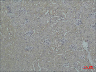 ZBTB45 Antibody
