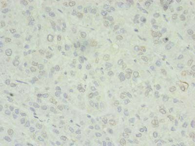 ZC3H7A Antibody
