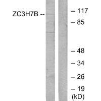 ZC3H7B Antibody