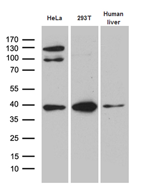 ZCCHC17 Antibody