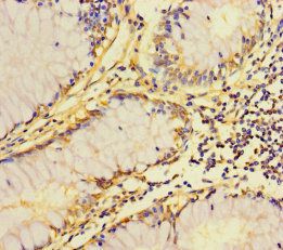 ZDHHC15 Antibody