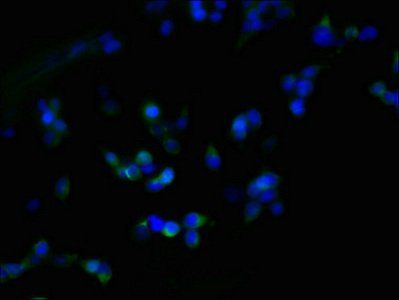 ZDHHC23 Antibody