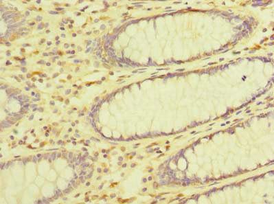 ZDHHC23 Antibody