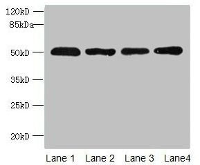 ZDHHC23 Antibody