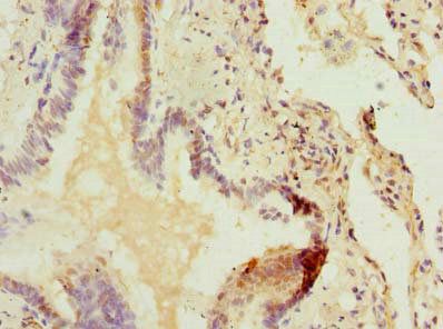 ZDHHC5 Antibody