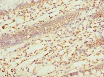 ZDHHC5 Antibody