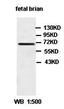 ZDHHC5 Rabbit Polyclonal Antibody