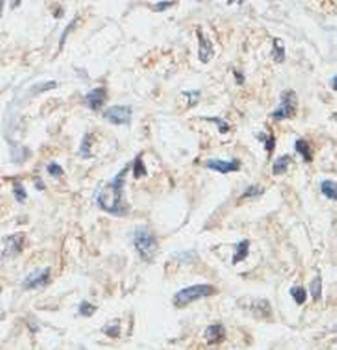 ZDHHC5 Rabbit Polyclonal Antibody