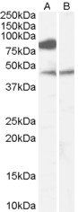 ZDHHC8 Antibody