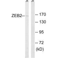 ZEB2 Antibody