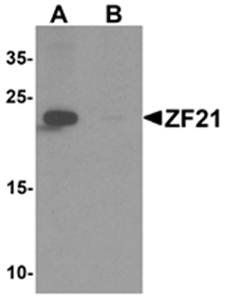 ZF21 Rabbit Polyclonal Antibody
