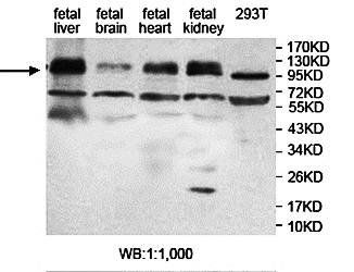 ZFP28 Rabbit Polyclonal Antibody