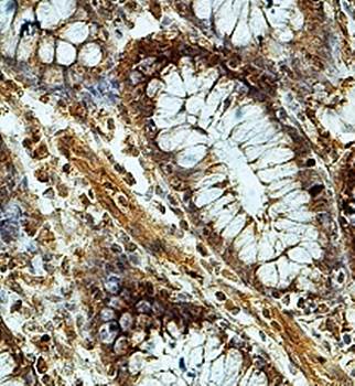 ZFP28 Rabbit Polyclonal Antibody