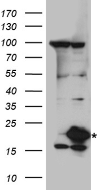 ZHX2 Antibody