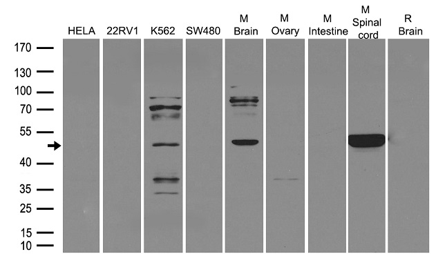 ZHX2 Antibody