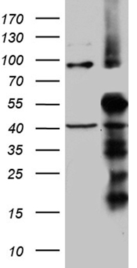 ZHX2 Antibody
