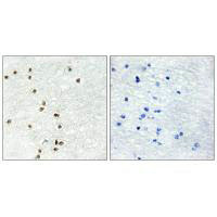 ZIC1 Antibody