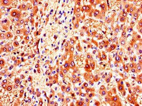 ZMPSTE24 Antibody