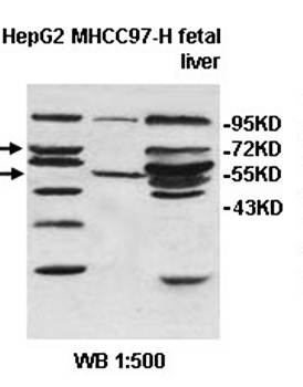 ZMYM5 Rabbit Polyclonal Antibody
