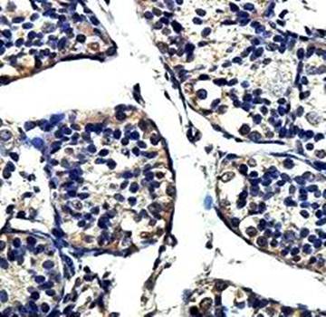ZNF10 Rabbit Polyclonal Antibody