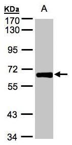 GALNT2 Rabbit Polyclonal Antibody