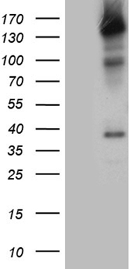 ZNF217 Antibody