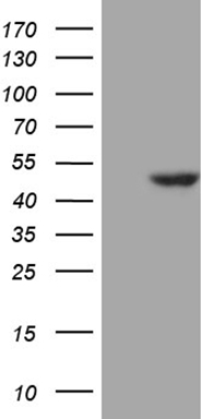 ZNF217 Antibody
