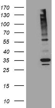 ZNF217 Antibody