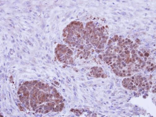 ZNF259 Rabbit Polyclonal Antibody