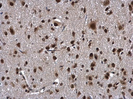 ZNF346 Rabbit Polyclonal Antibody